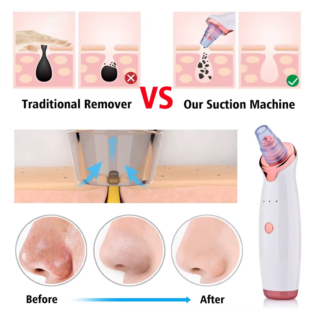 Vacuum Blackhead Removal Facial Cleansing Black Spots Suction Acne Pimple Remover Beauty Instrument USB Charge Skincare Tools